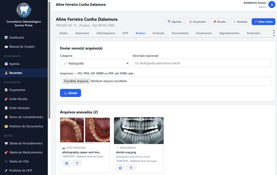 Anexos do paciente: radiografias e fotos intraorais
