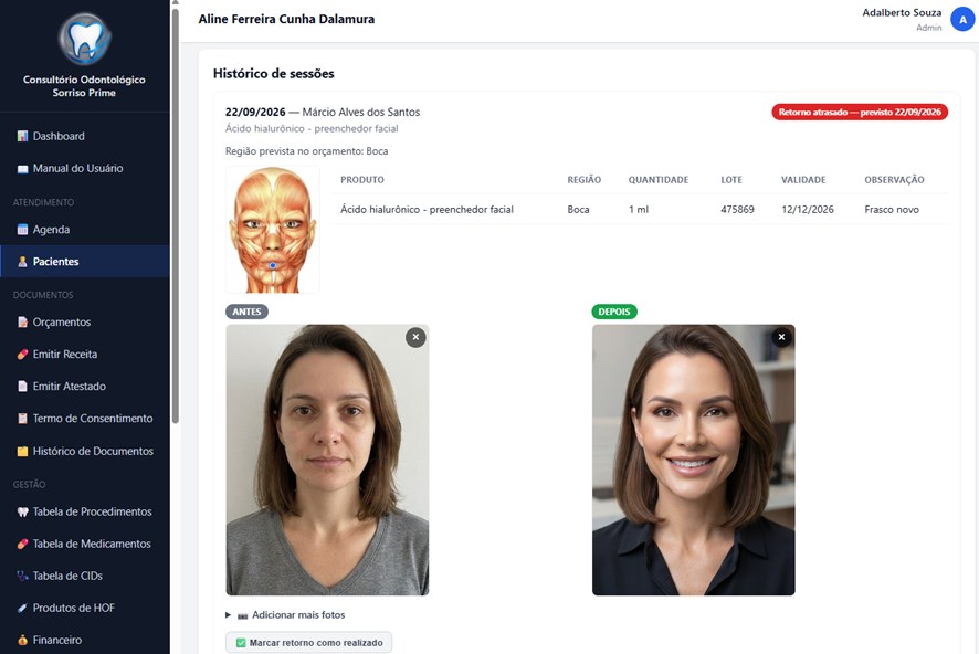 Pincus: histórico de sessões de Harmonização Orofacial com fotos de antes e depois